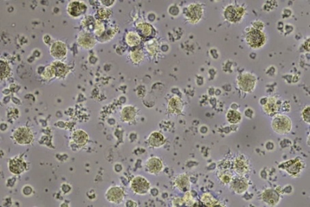 Harvest cells-2.png Harvest cells-2.png